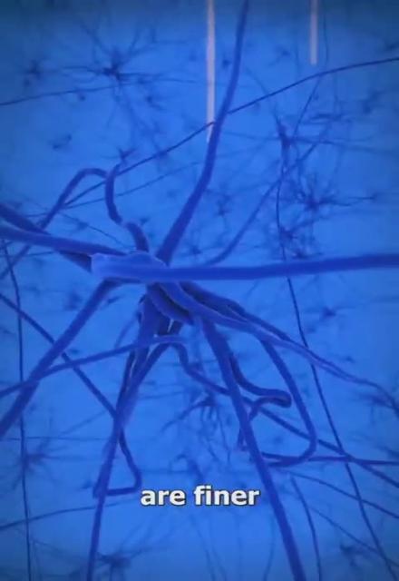This is how they install a Neuralink...  Who's signing up?