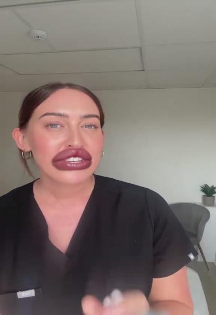 Ladies - what’s stopping you making an appointment to get lips like hers?