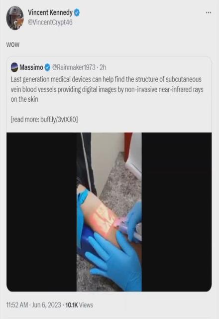 Could this be the similar tech they will someday use as The Mark of The Beast for those who got the CLOTSHOT